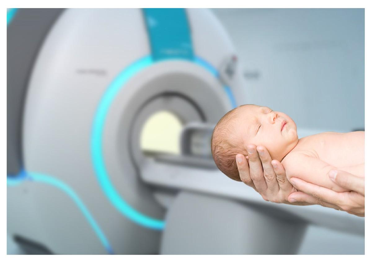 Euronoxx Medical Group Neona MRI with MR compatible neonatal incubator for safe and stable infant imaging during scans